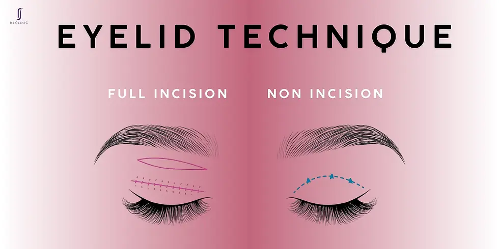 eyelid techniques full incision and non incision