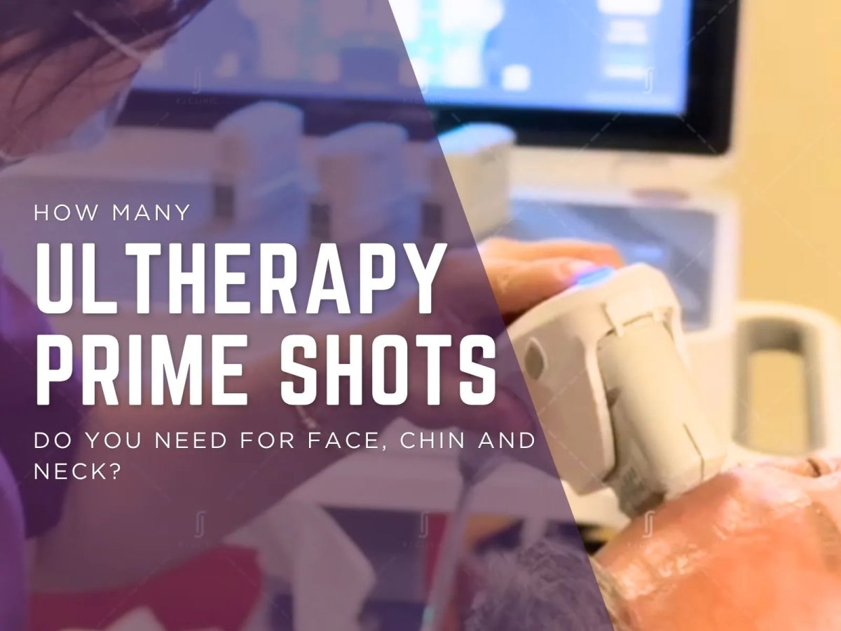 How Many Ultherapy Prime Shots Do You Need for Face, Chin and Neck?