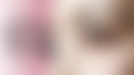 double eyelid suture in rj clinic