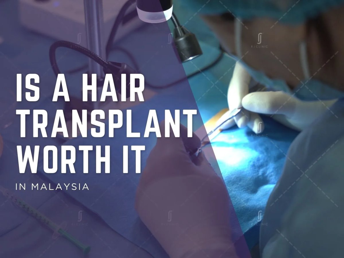 Is a Hair Transplant Worth It in Malaysia? A Clinical ROI Analysis (2026)
