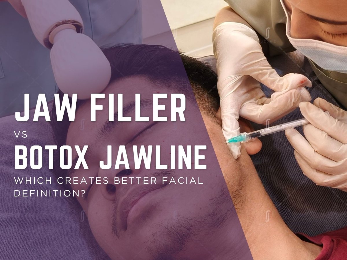 Jaw Filler vs Botox Jawline: Which Creates Better Facial Definition?
