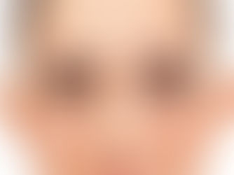 difference between young and old skin