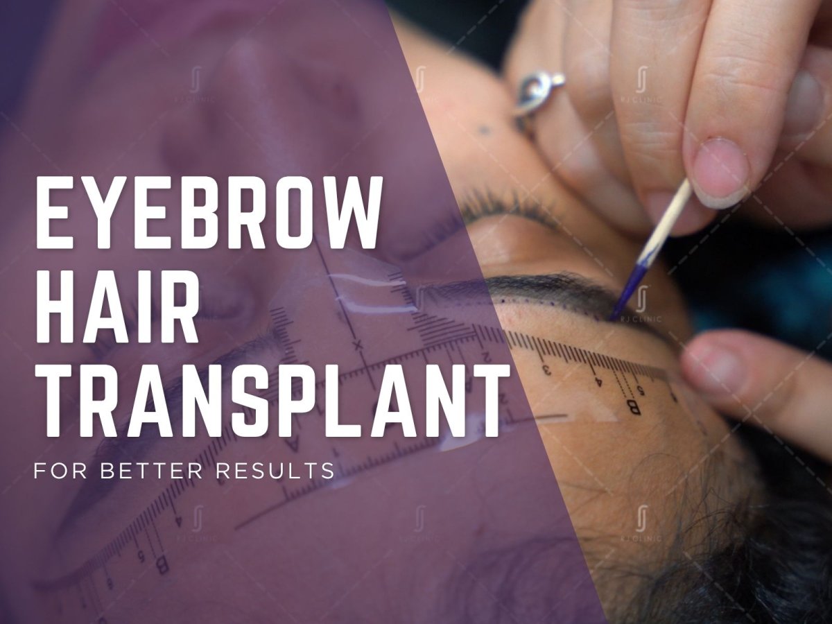 Eyebrow Hair Transplant in Malaysia: What Results Can You Expect?