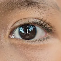 rj clinic double eyelid