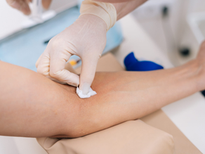 Top 5 Tips for IV Insertion: Enhancing Technique with Data-Driven Insights
