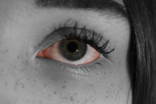 Red Eye-min.jpg