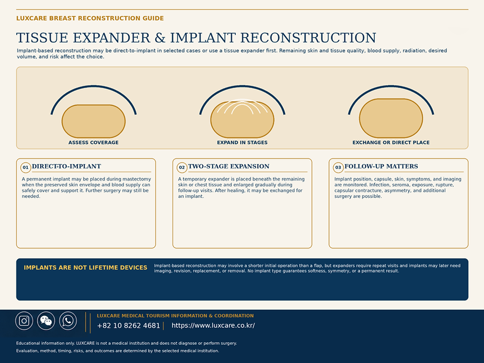 03_breast_reconstruction_expander_implant_en_2880x2160(1)_no_page_badge.png