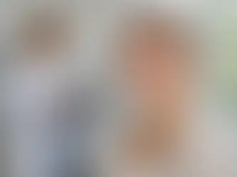 RF Microneedling Side Effects: What's Normal and What's Not