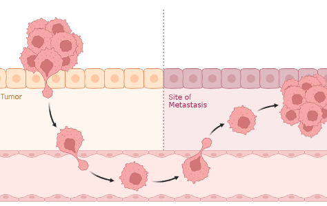 Metastasis Mechanism
