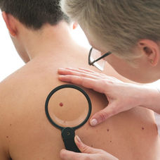 Spot It Early: How to Do a Skin Self-Exam
