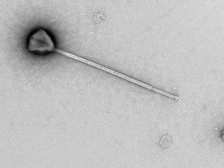 Giant Virus With Record-Long Tail Discovered in Pacific Ocean