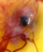 Embryo Study V