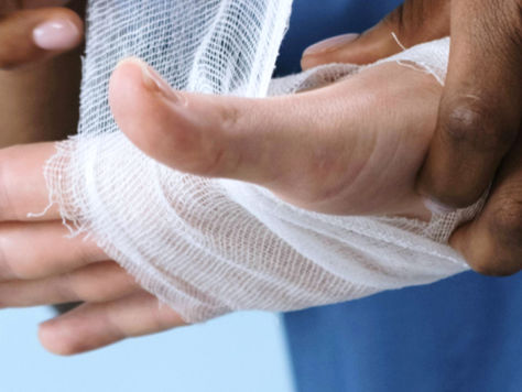 Lesiones en las manos por tejer: lo que nadie te dice y necesitas saber