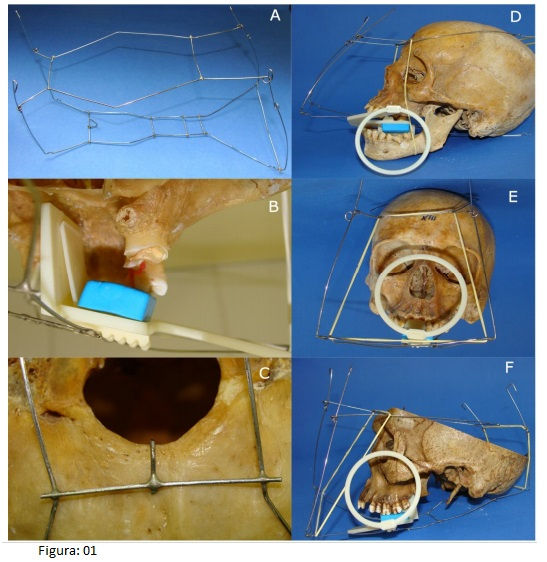 Armadura para radiografia periapical