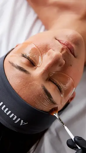 Chemical Peel/Facial