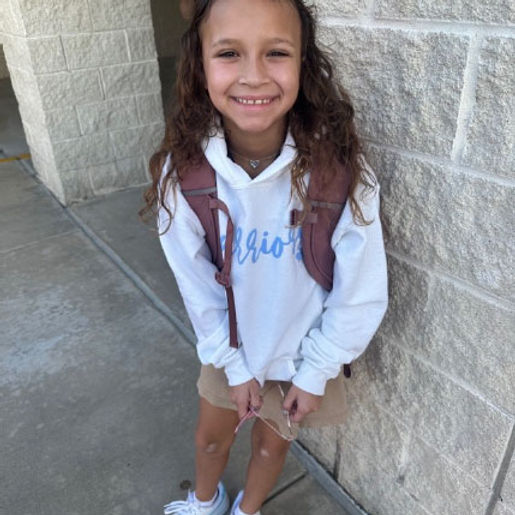 Natalia's Story Living with Alopecia Areata