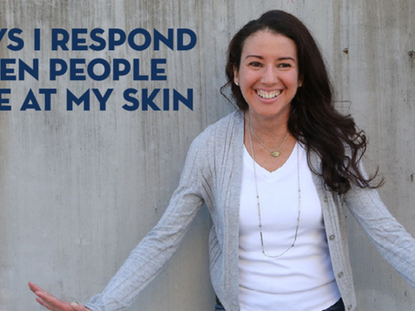 3 ways I respond when people stare at my skin
