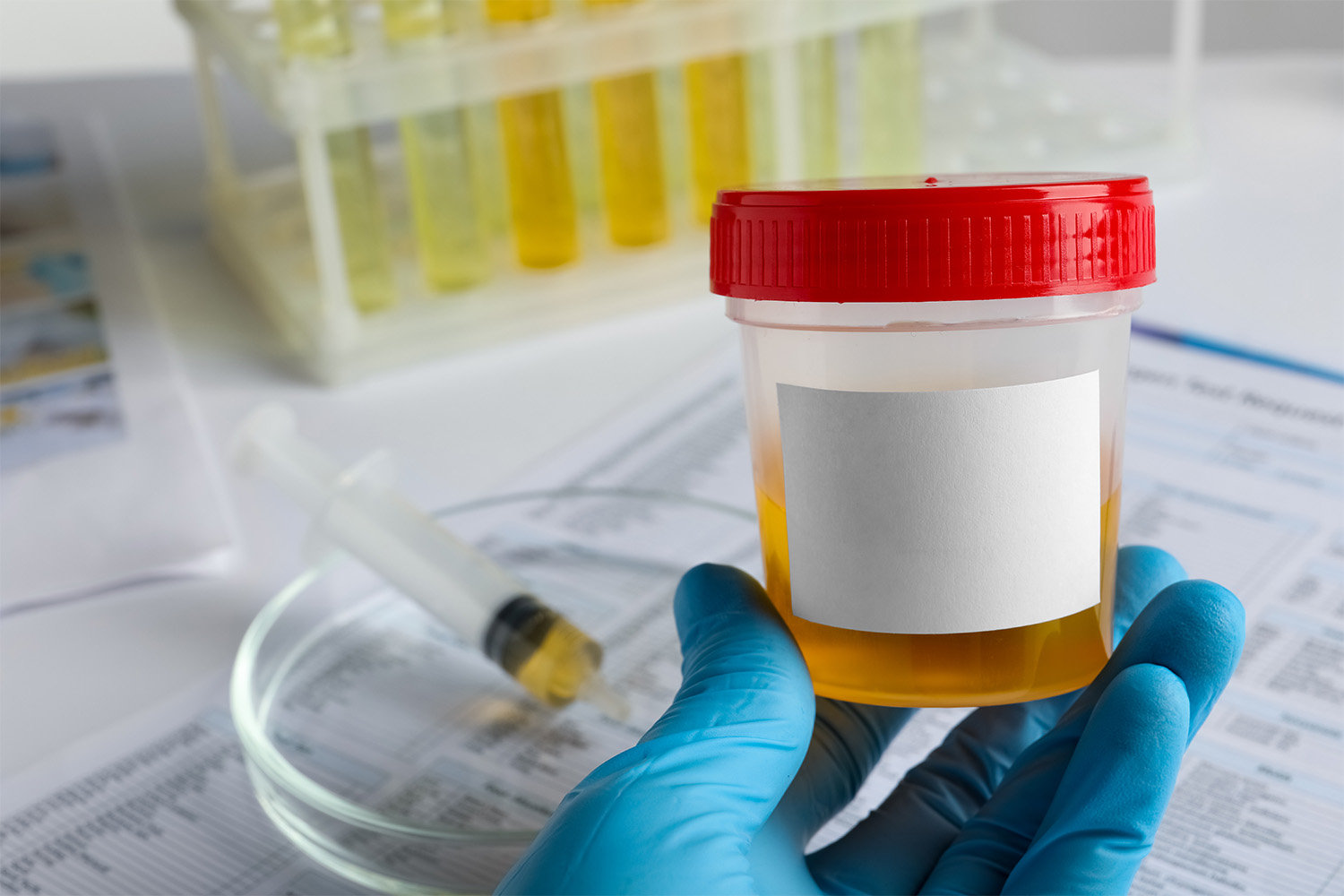 Raip Lab Rapid/ Lab Urine Drug Test (5-16 Panels) | TruMark Diagnostics LLC
