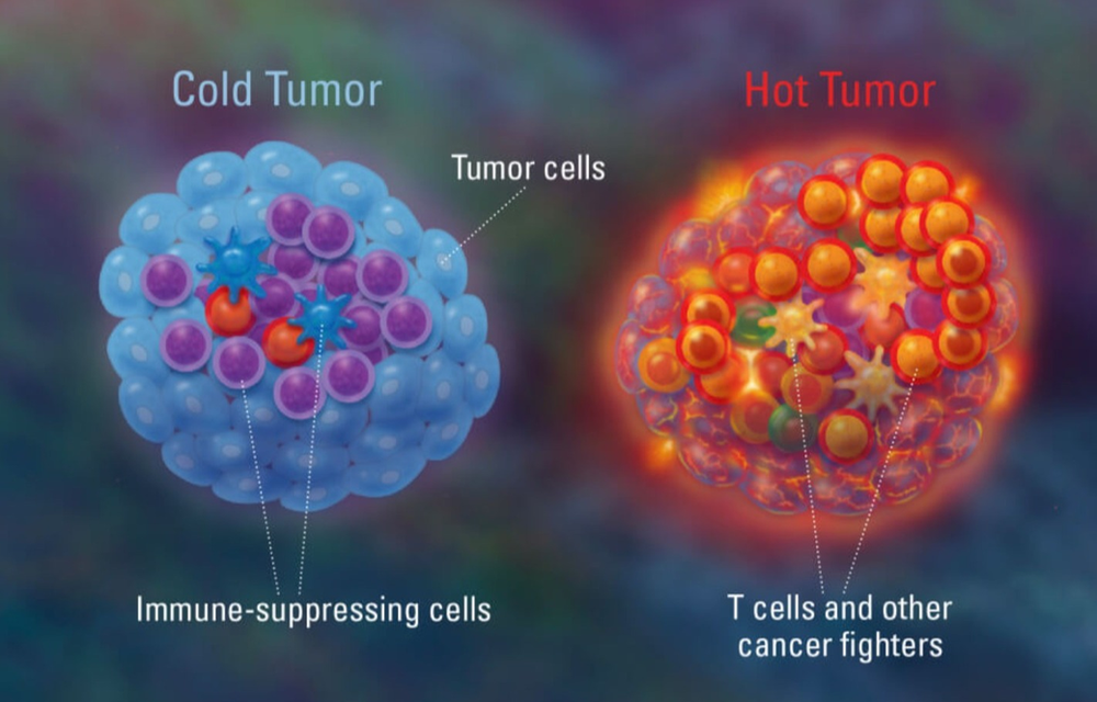 IL-12 may be able to change the tumor microenvironment, turning a