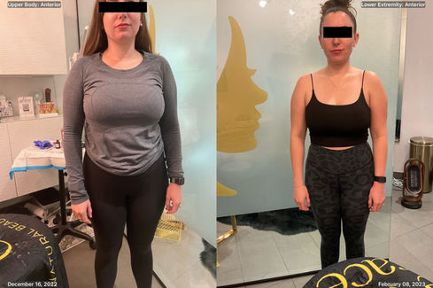 Semaglutide Weight Loss