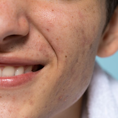 front-view-smiley-young-man-skin-texture.jpg