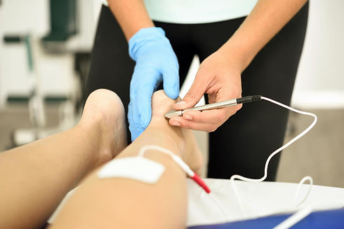Physiotherapy Dry Needling.jpg