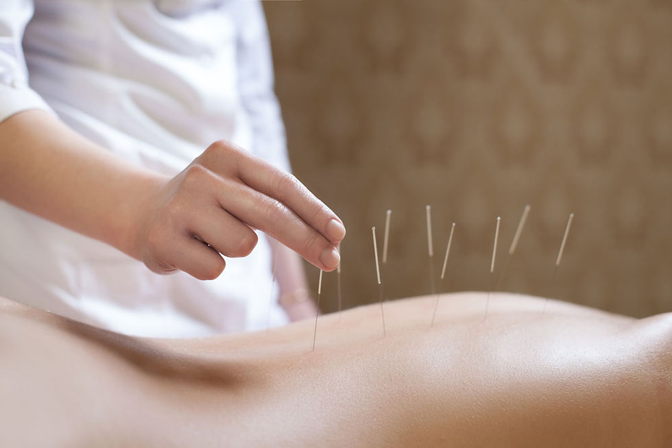 Laser-acupuncture-robina
