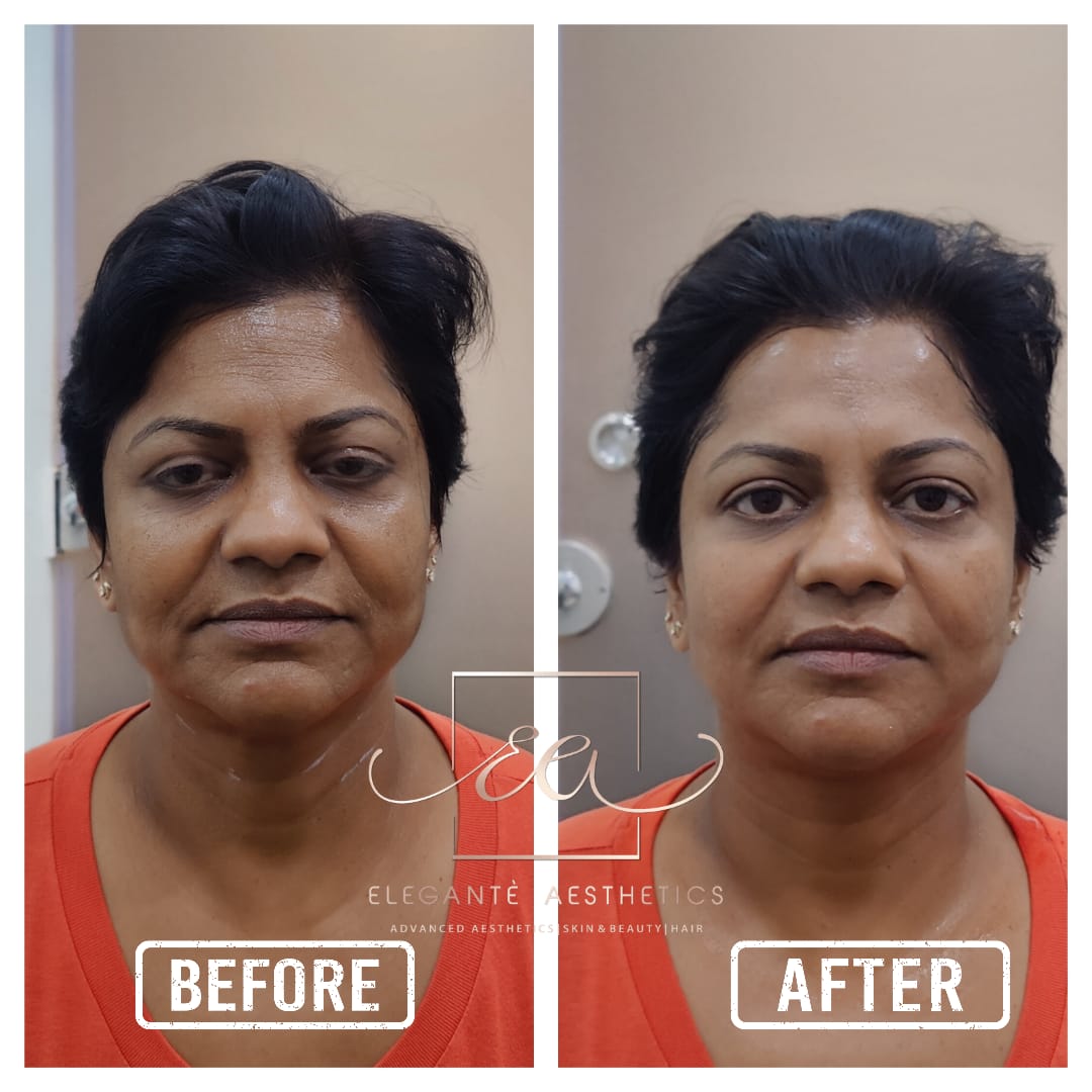 Patient transformation