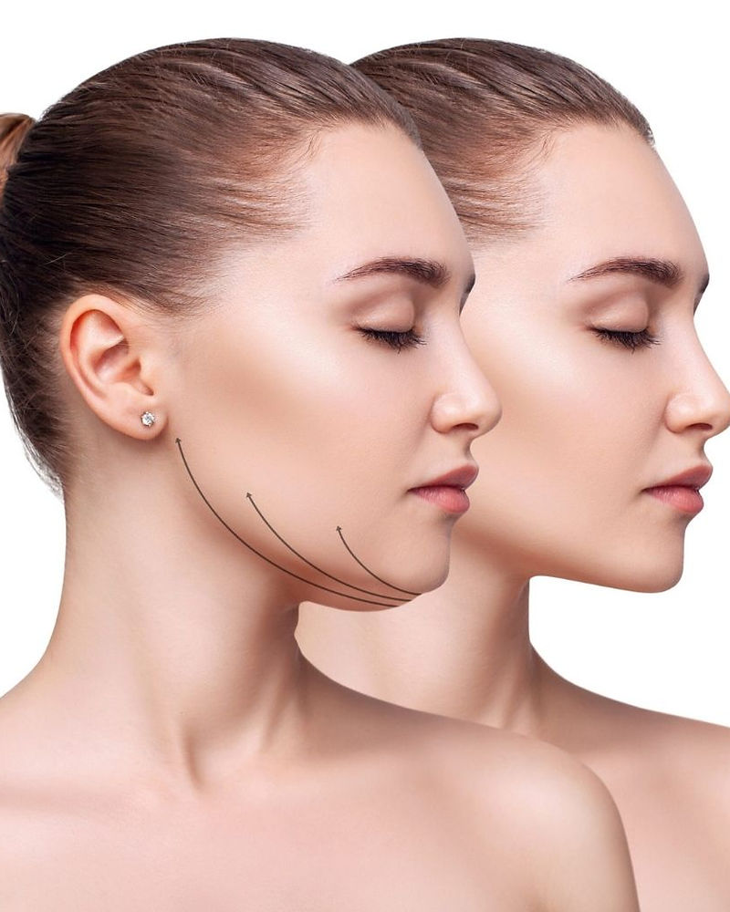 Cryolipolysis science and technology at Elegantè Aesthetics