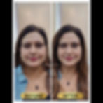 Before and After