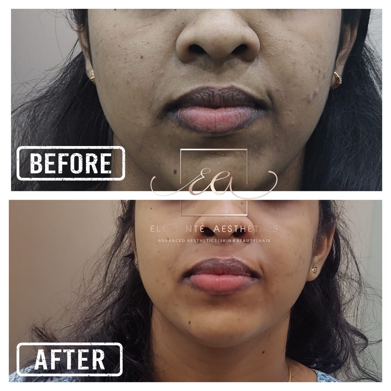 Patient transformation