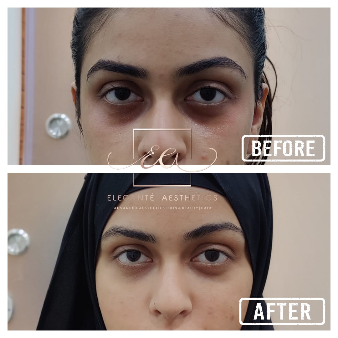 Patient transformation