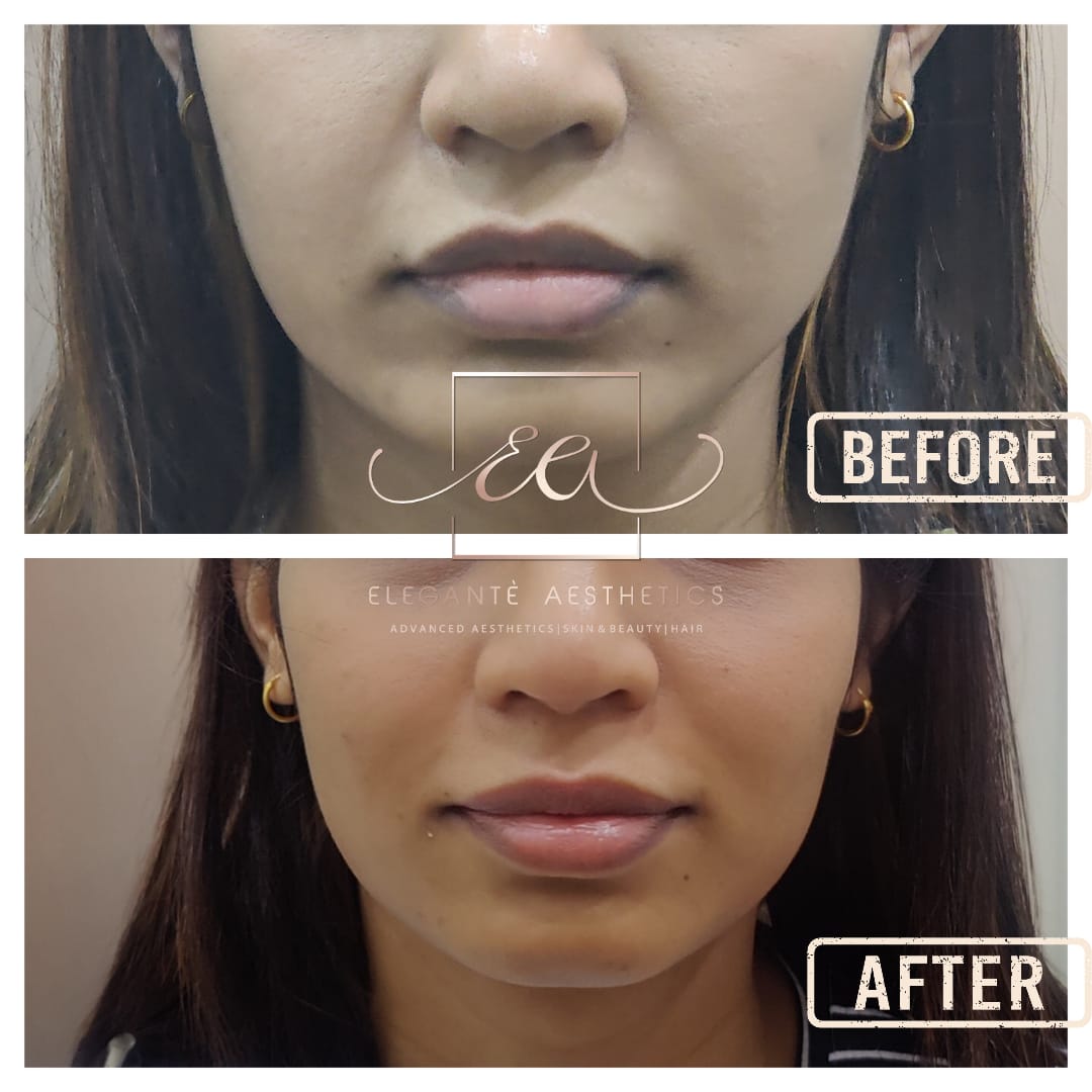 Patient transformation