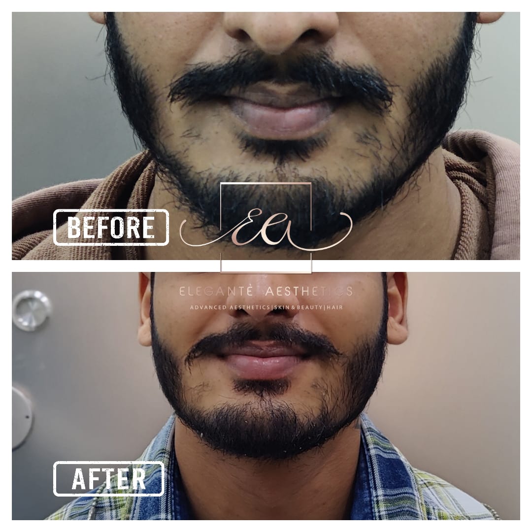 Patient transformation