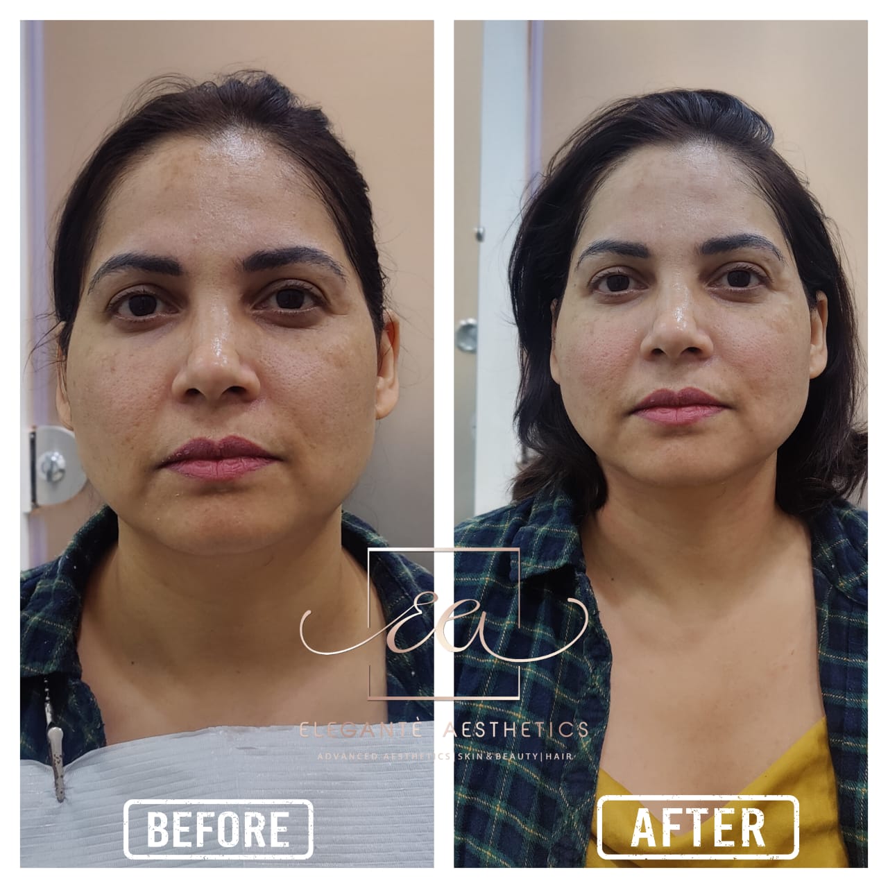 Patient transformation
