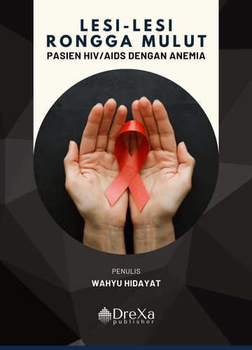 Lesi-Lesi Rongga Mulut: Pasien Hiv/Aids Dengan Anemia | Drexa Publisher
