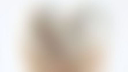 Dentes trincados e sem dor: monitorar até que ponto?