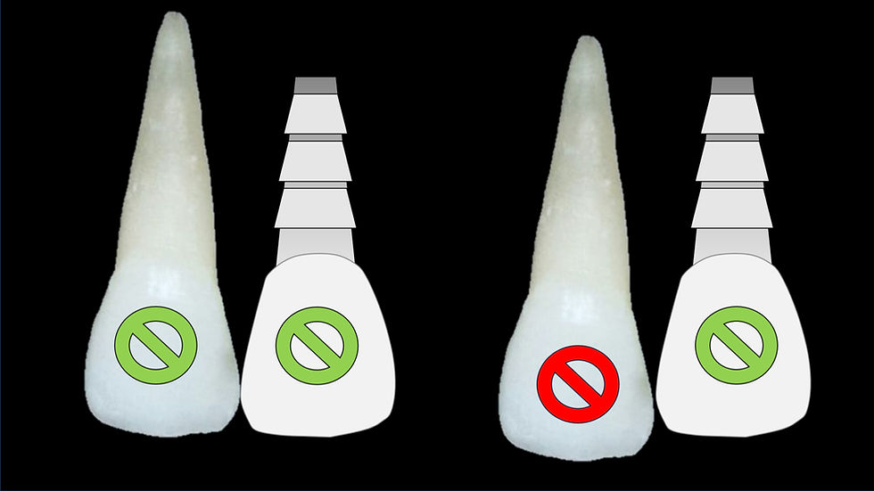 Extrusão dentária e o implante adjacente.