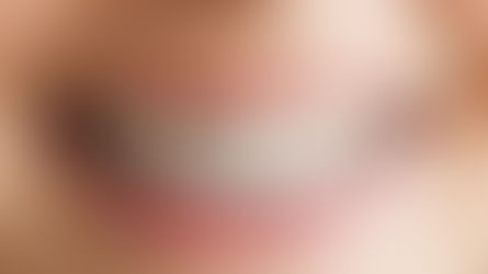 A Ortodontia é um mecanismo de "inflamação controlada"?
