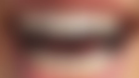 Férias e esportes radicais: os seus dentes estão protegidos?