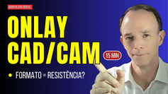 Onlay CAD/CAM: dissilicato de lítio e sua resistência