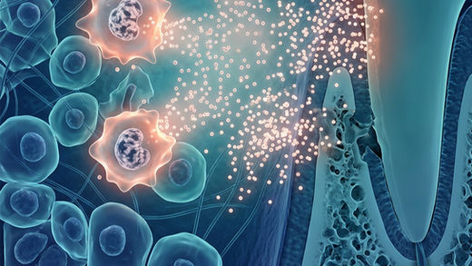 Senescência: o periodonto envelhece, a doença periodontal avança.