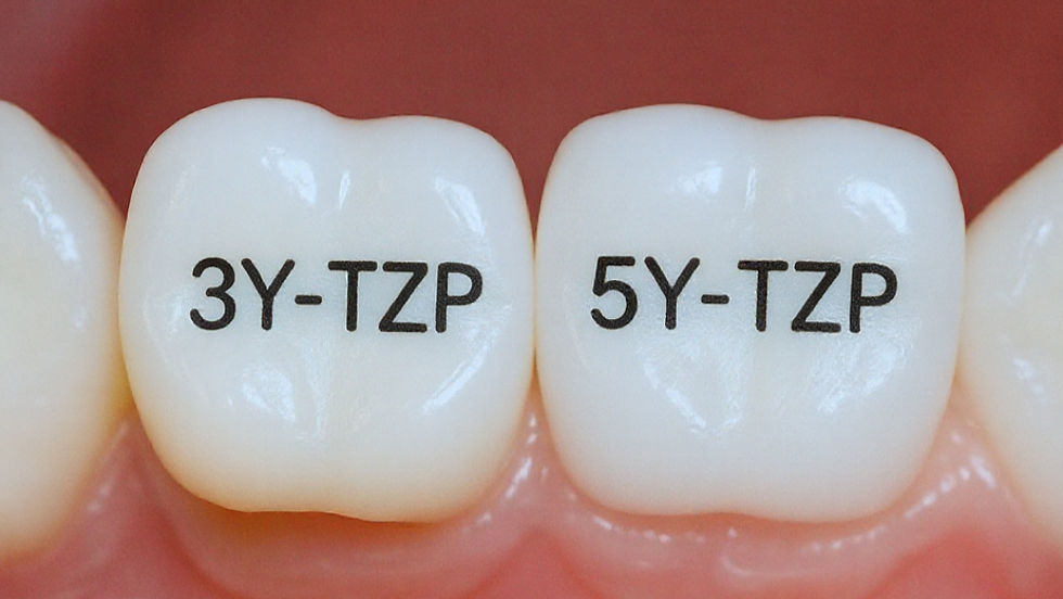 Zircônias 3Y-TZP e 5Y-TZP: para que tanta pressa no forno? Imagem: I.A.