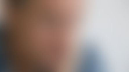 Dor de dente aumenta o risco de Alzheimer? Entenda (e acalme-se)