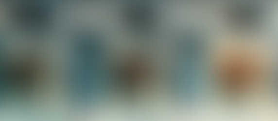 Overlays em dentes posteriores: o nível de cobertura muda totalmente o jogo. Foto: I.A.