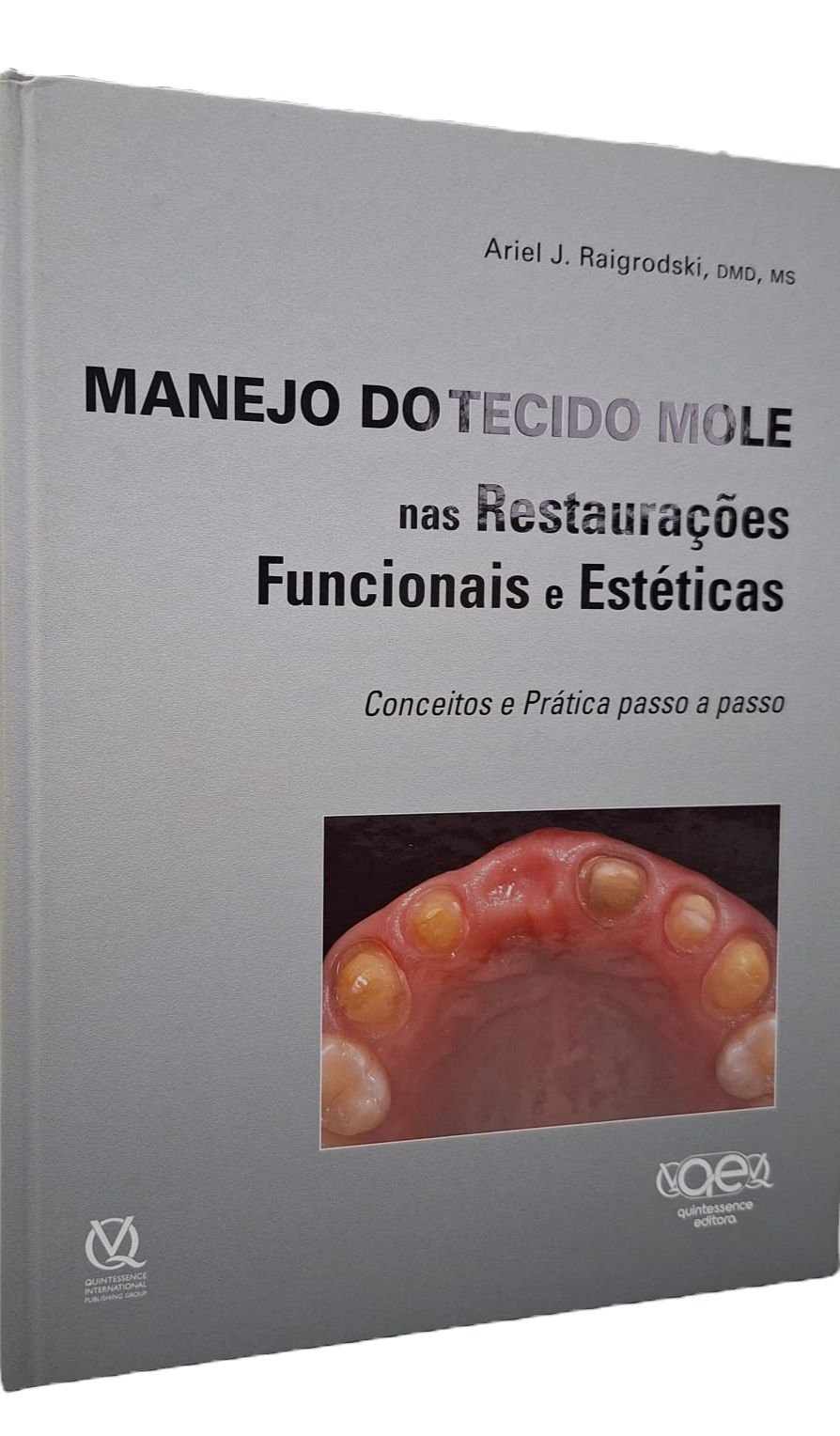 Manejo do tecido mole. Ariel Raigrodski.
