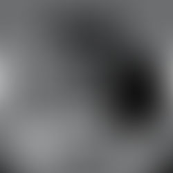 Seio maxilar: sinusites geradas por implantes dentários?