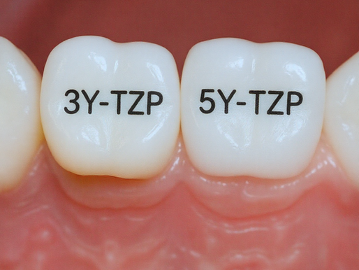 Zircônias 3Y e 5Y: para que tanto pressa no forno?