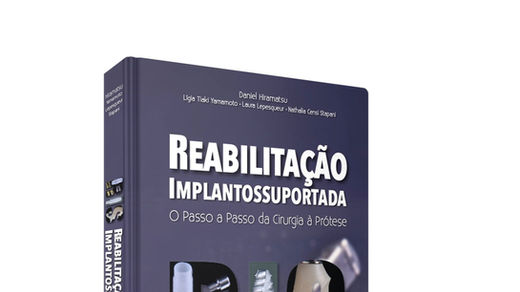 Reabilitação Implantossuportada. Foto: Santos Publicações Ltda.