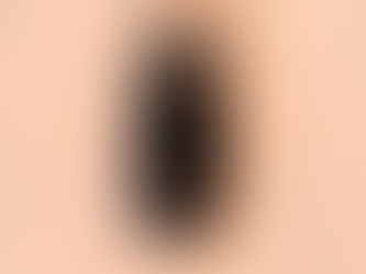 O ciclo de vida do implante dentário: como gerenciar no consultório?